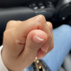 Gel that wasn't properly removed