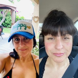 Revay Aesthetics - Before on the left and after on the right. Thank you Revay you are a blessing!