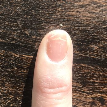 Elite Nails - My nail was sanded down so aggressively that my nail split all the way across and through to the skin. - Nail Salons Near Me - Carpinteria, California Elite Nails - My nail was sanded down so aggressively that my nail split all the way across and through to the skin. - Nail Salons Near Me - Carpinteria, California