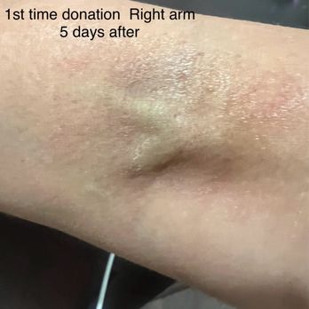 Biomat USA - 1st time donation (angry lady ) - Blood & Plasma Donation Centers Near Me - Kissimmee, Florida Biomat USA - 1st time donation (angry lady ) - Blood & Plasma Donation Centers Near Me - Kissimmee, Florida