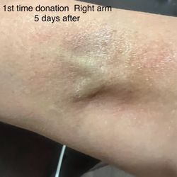 Biomat USA - 1st time donation (angry lady )
