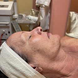 Marine's Waxing & Skin Care - BEFORE photo of my beautiful 66 yr old friend. Experiencing dehydrated/flaky skin and lips.