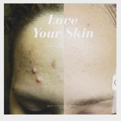 re-nu Rejuvenation & Wellness