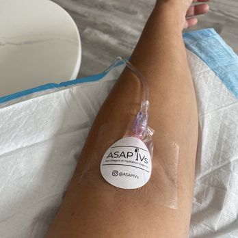 ASAP IVs - IV Hydration Near Me - La Jolla, California