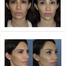 Bao L Phan, MD - Hawaii Plastic Surgery Institute