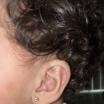 Friendly Hills Pediatrics - Ear piercing done with piercing gun - Pediatricians Near Me - Whittier, California