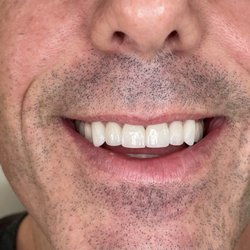 Alex Kalmanovich, DDS - Laguna Family Dentistry - Veneers