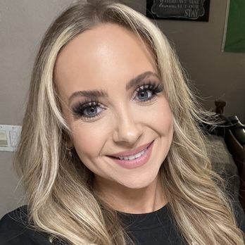 XUNA Aesthetics - Tox in forehead. - Medical Spas Near Me - Vacaville, California