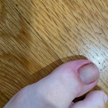Fuchsia Beauty Lounge Astoria - This is 10 mins after getting my nails "cleaned" - Nail Salons Near Me - Astoria, New York