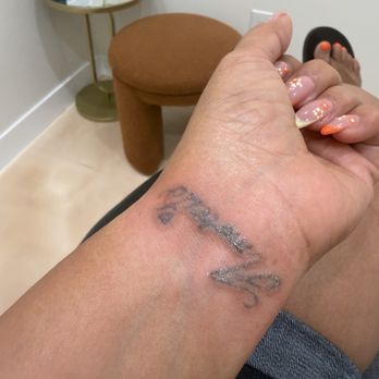 JT Aesthetic - Tattoo Removal Near Me - Eastvale, California JT Aesthetic - Tattoo Removal Near Me - Eastvale, California