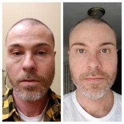 We Rejuvenate You