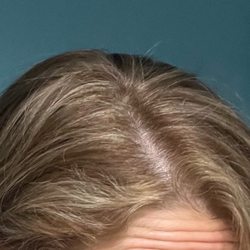 Shears By Friends Beauty - A week prior, I was given a hairdo that made me cry and wear a hat. At Bella America they bleached my scalp! Shears saved my hair.