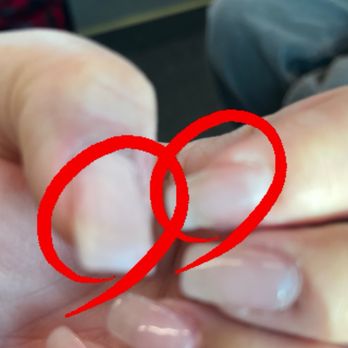 Millenia Nails & Day Spa - Other hand 2 nails - This is "supposed to be GEL $15.00 + tip" 2nd time back to "fix" - Day Spas Near Me - Orlando, Florida
