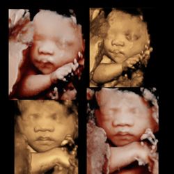 3DBabyVu - 3D vs 5D