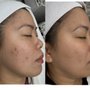 Unblemished Skin Studio