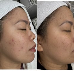 Unblemished Skin Studio