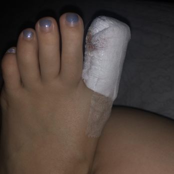Gaia Nails - After I had to get my toe nail removed - Nail Salons Near Me - Benicia, California Gaia Nails - After I had to get my toe nail removed - Nail Salons Near Me - Benicia, California