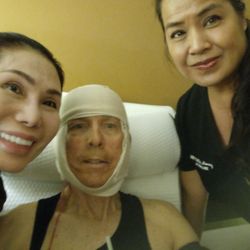 NipTuck Nursing Aftercare - 4 Hrs after Face & Neck Lift..in Great care with Olivia @ Nip/,Tuck Nursing Aftercare!