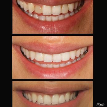 Mark Kuioka, DDS - General Dentistry Near Me - Aiea, Hawaii