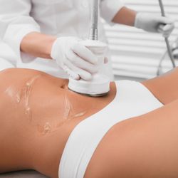 VIA Health & Medspa - Our Chandler office cellulite treatment options include radiofrequency technology, ZWave, Subcision and QWO.