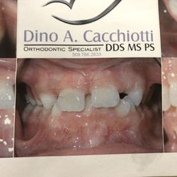Dino A. Cacchiotti, MS, DDS - BEFORE
