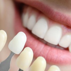 Spring Valley Dental