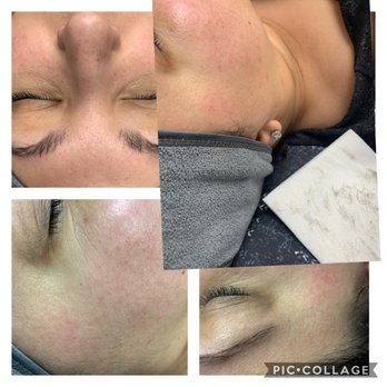 RAE Aesthetic's - Skin Care Near Me - Kent , Ohio RAE Aesthetic's - Skin Care Near Me - Kent , Ohio