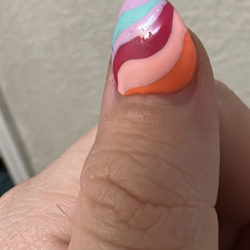 Crooked af and distanced nailbed