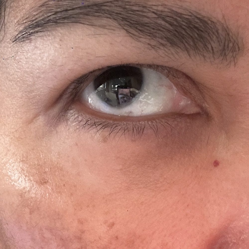 Td Aesthetics - No solución . - Medical Spas Near Me - Los Angeles, California Td Aesthetics - No solución . - Medical Spas Near Me - Los Angeles, California