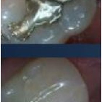 Frank C. Prezioso, DMD - Pediatric Dentists Near Me - Yardley, Pennsylvania Frank C. Prezioso, DMD - Pediatric Dentists Near Me - Yardley, Pennsylvania