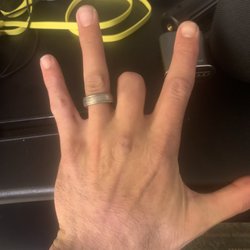 Hands On Hands Rehabilitation Center - Huntington Beach - Helped get my finger working again!