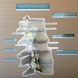 Ziegler Chiropractic Clinic - Vertebral Subluxation