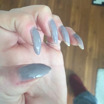 Trending Nails Spa - This is what they look like today--3 days later. Worst job ever. And notice the cuticles. - Waxing Near Me - San Jose, California Trending Nails Spa - This is what they look like today--3 days later. Worst job ever. And notice the cuticles. - Waxing Near Me - San Jose, California