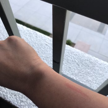 Loma Spa - Burns from getting a wax!! - Nail Salons Near Me - Cupertino, California Loma Spa - Burns from getting a wax!! - Nail Salons Near Me - Cupertino, California