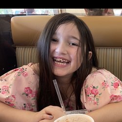 Larson Orthodontics Riverside - Before braces