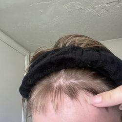 My hairline.
