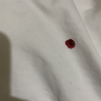 Hotel Economico - Dead bedbug that full of my blood - Hotels Near Me - Tijuana, BCN Hotel Economico - Dead bedbug that full of my blood - Hotels Near Me - Tijuana, BCN