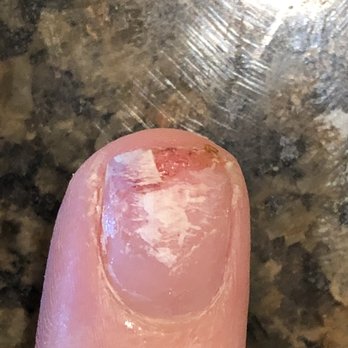 Envy Nails & Spa - Broken nail - Nail Salons Near Me - Fort Myers, Florida