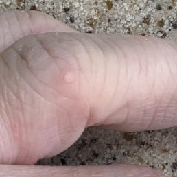 Caught warts from Fantastic Day spa manicurist