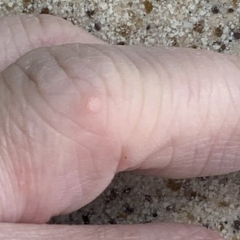 Fantastic Day Spa - Caught warts from Fantastic Day spa manicurist - Day Spas Near Me - Farmingdale, New York