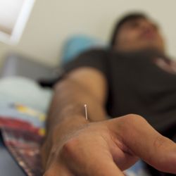 Lotus Wellness Center - Acupuncture!