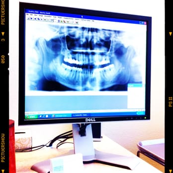 Robert Ferdowsmakan, DMD, MD - 4-quadrant panorama used during consultation - Oral Surgeons Near Me - San Diego, California Robert Ferdowsmakan, DMD, MD - 4-quadrant panorama used during consultation - Oral Surgeons Near Me - San Diego, California