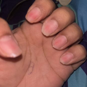 Lavish Nail Spa - Removed only some areas and left to thin that it hurts - Nail Salons Near Me - Garland, Texas Lavish Nail Spa - Removed only some areas and left to thin that it hurts - Nail Salons Near Me - Garland, Texas