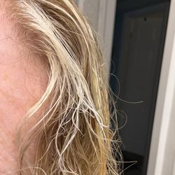 Hair breakage before it fell out