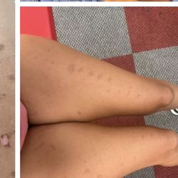 Solo Studio - 2026 legs