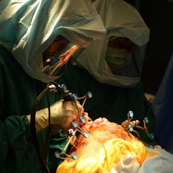 Mercury News goes behind the scenes into Dr. Iyengar: http://www.mercurynews.com/2017/05/31/the-robot-revolutionizing-knee-replacemen
