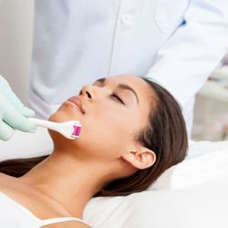 Total Vitality Centre - Microneedling