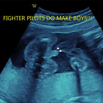 Advanced Ultrasound Services - Diagnostic Imaging Near Me - Tampa, Florida Advanced Ultrasound Services - Diagnostic Imaging Near Me - Tampa, Florida