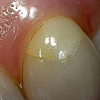 Southgate Dental Care - Dentists Near Me - London, XGL