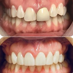 Kingston Family Cosmetic Dental Center
